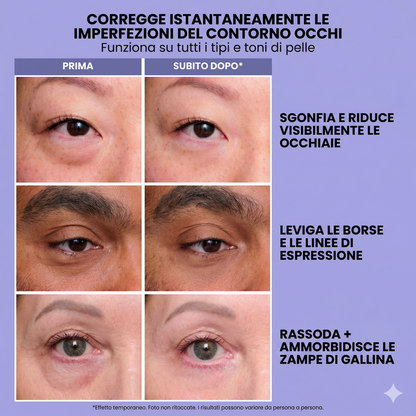 InfiniteLift - Gel rassodante e ringiovanente per il contorno occhi
